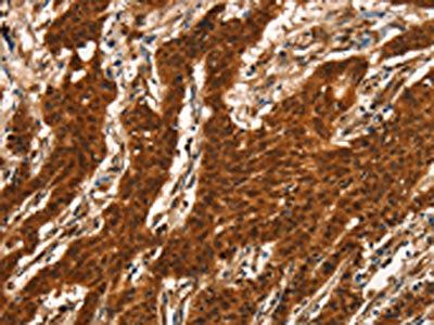 CTNNBIP1 Antibody