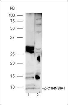 CTNNBIP1 (phospho-Thr43/Ser50) antibody