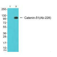 CTNND1 (Ab-228) antibody