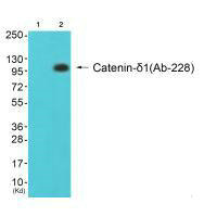 CTNND1 (Ab-228) Antibody