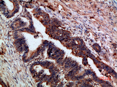CTNND1 Antibody