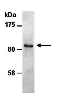 CTNND1 (M) Antibody, Rabbit Polyclonal
