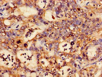 CTNND1 Antibody