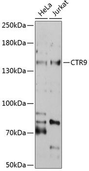 CTR9 antibody