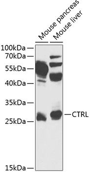 CTRL antibody