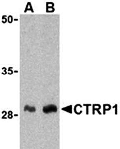 CTRP1 Antibody