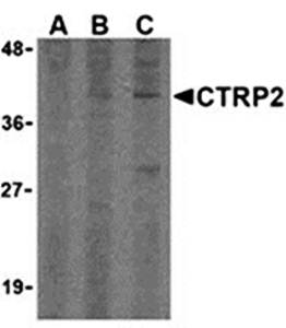 CTRP2 Antibody