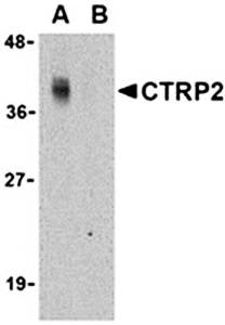 CTRP2 Antibody