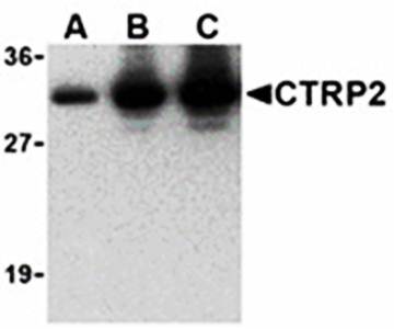 CTRP2 Antibody