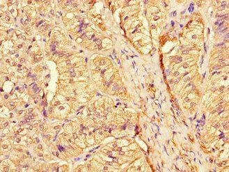 CTSA antibody