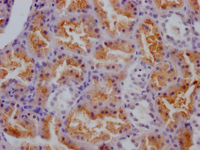 CTSS Recombinant Monoclonal Antibody