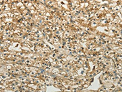 CTSV Antibody
