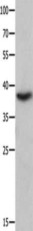 CTSV antibody