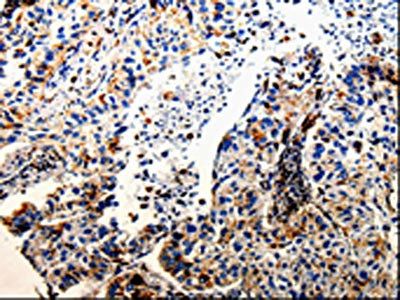 CTSZ Antibody