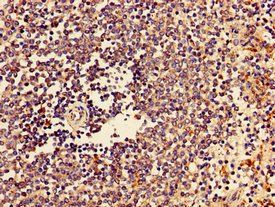 CTSZ Antibody
