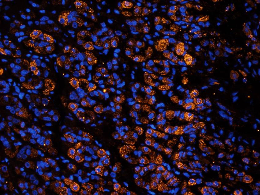 Cubilin Rabbit Polyclonal Antibody
