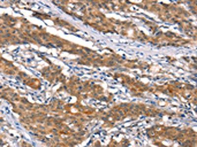 CUL4B Antibody