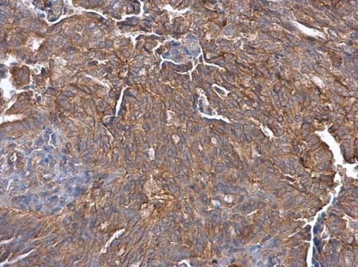 Cullin 7 Rabbit Polyclonal Antibody