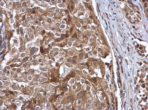 Cullin 7 Rabbit Polyclonal Antibody