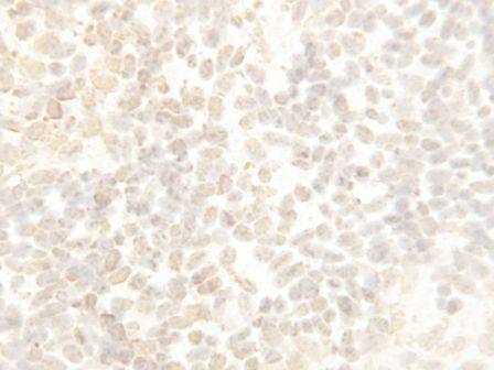 Anti-Cullin 4B/CUL4B Antibody