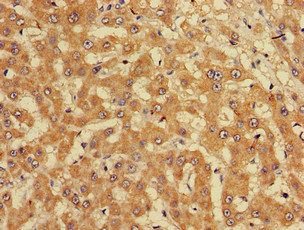 CUTA Antibody