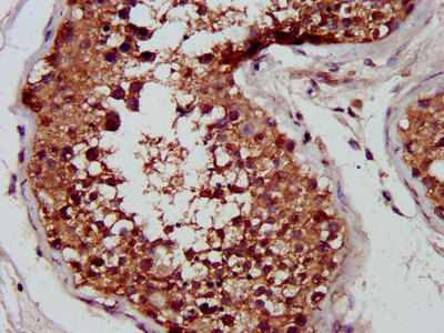 CUTC Antibody