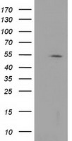 cvHSP (HSPB7) antibody
