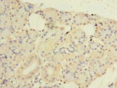 CWF19L1 Antibody
