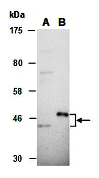 CX3CR1 (C) Antibody, Rabbit Polyclonal