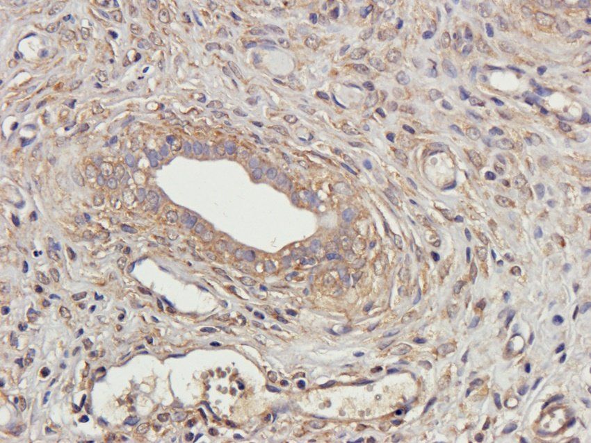 CXCL10 Rabbit Polyclonal Antibody