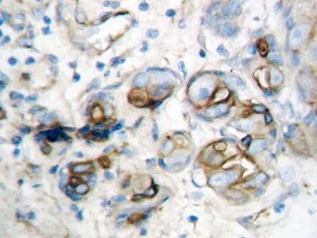 Anti-IP10/CXCL10 Antibody