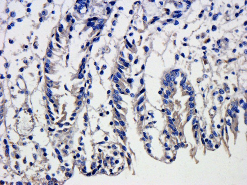 CXCL11 antibody