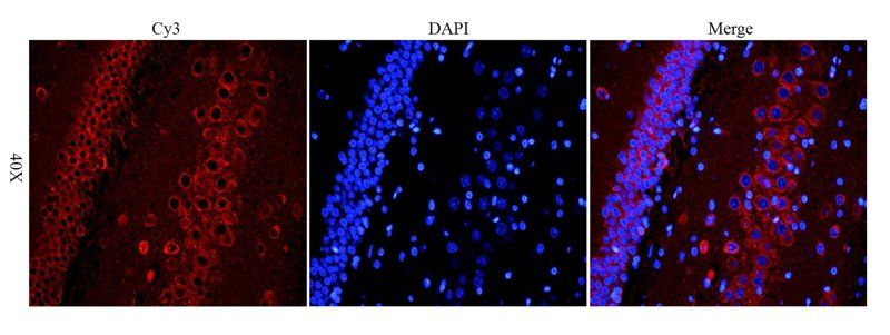 CXCL11 antibody