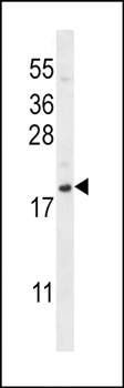 SDF1 antibody