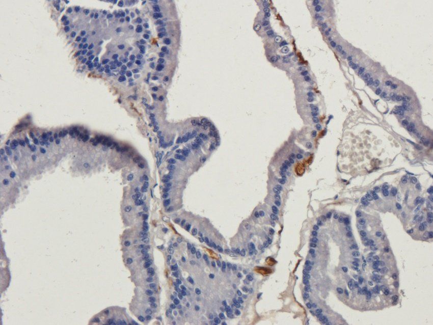 CXCL13 antibody