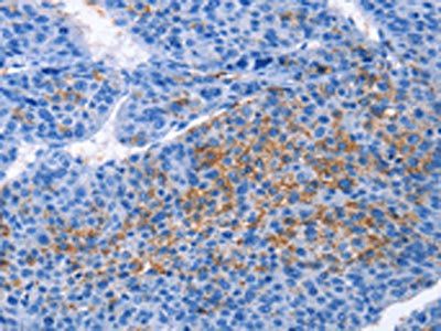 CXCL3 Antibody
