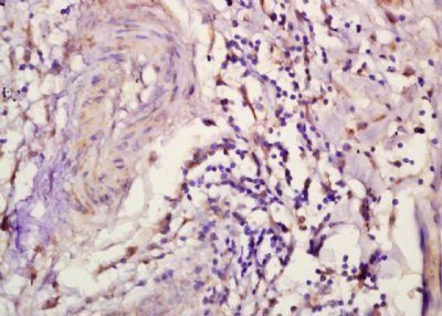 CXCL3 Rabbit Polyclonal Antibody