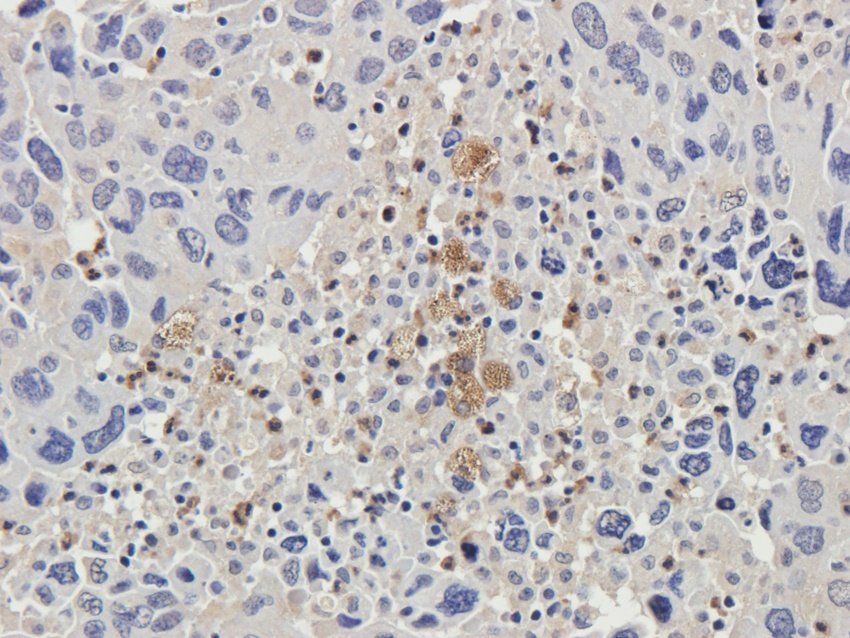 CXCL5 Rabbit Polyclonal Antibody