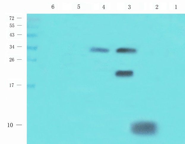 CXCL5 antibody