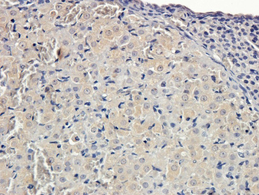 CXCL5 antibody