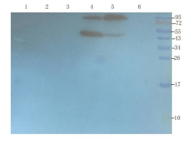 CXCL5 antibody