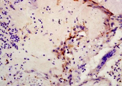 CXCL6/GCP2 Rabbit Polyclonal Antibody