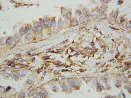 Anti-MIG/CXCL9 Antibody