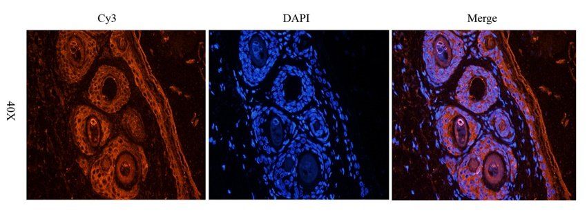 CXCR1 antibody