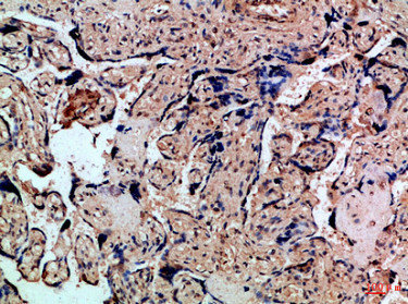 CXCR1 antibody