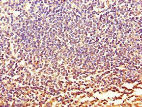 CXCR2 Antibody