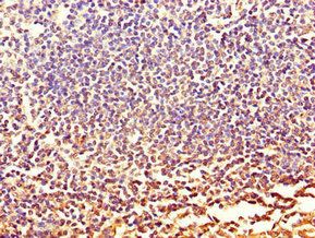 CXCR2 antibody