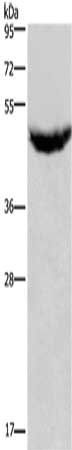 CXCR2 antibody