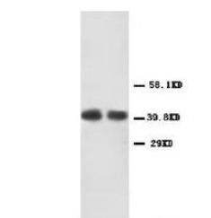 Anti-CXCR2 Antibody