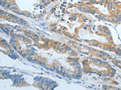 CXCR3 Antibody